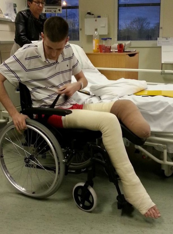 Man lost leg after “pals set him on fire as he slept drunk on bathroom floor” Man lost leg after “pals set him on fire as he slept drunk on bathroom floor”