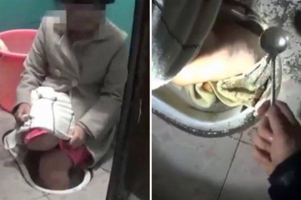 Woman stuck in toilet 