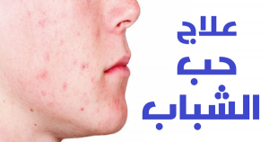 ما هي اسباب ظهور حب الشباب وطرق علاجه ما هي اسباب ظهور حب الشباب وطرق علاجه
