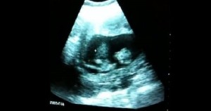 Unborn Baby Playing in Mommy’s Tummy Video