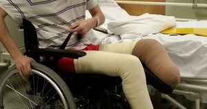 Man lost leg after “pals set him on fire as he slept drunk on bathroom floor” Man lost leg after “pals set him on fire as he slept drunk on bathroom floor”